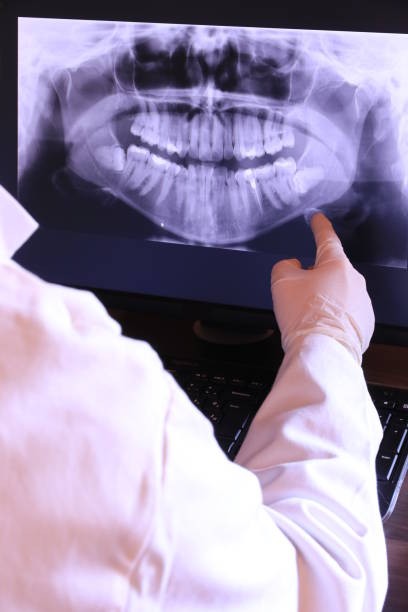 Best Knocked-Out Tooth (Avulsed Tooth) Treatment in Trumansburg, NY